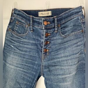 Madewell Button Fly Skinny Distressed Jeans